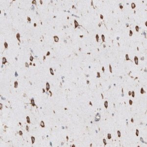 Anti-RPLP1 antibody produced in rabbit 
