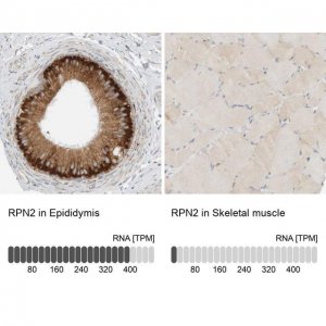 Anti-RPN2 antibody produced in rabbit HPA025922-100UL
