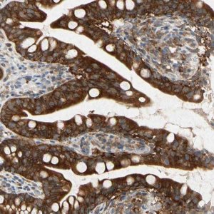 Anti-RPS6KA1 antibody produced in rabbit HPA007981-100UL