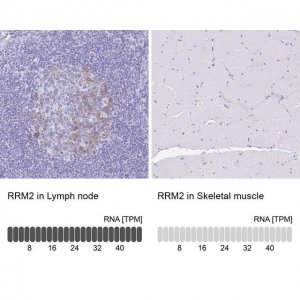 Anti-RRM2 antibody produced in rabbit 