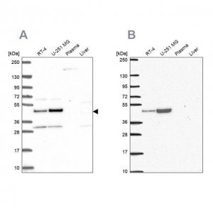 Anti-RRS1 antibody produced in rabbit HPA060937-100UL