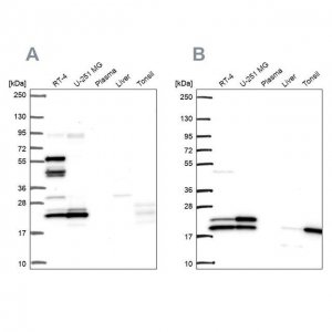 Anti-RSL24D1 antibody produced in rabbit 