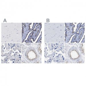Anti-RSPH1 antibody produced in rabbit 