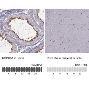 Anti-RSPH6A antibody produced in rabbit 