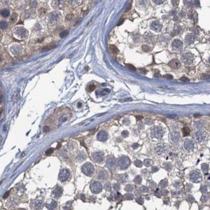 Anti-RTKN2 antibody produced in rabbit 