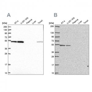Anti-RUVBL2 antibody produced in rabbit HPA042880-100UL