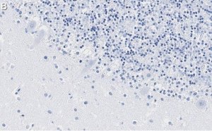 Anti-S100-B Antibody, clone 8F20 ZooMAb� Rabbit Monoclonal 