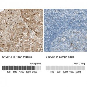 Anti-S100A1 antibody produced in rabbit 