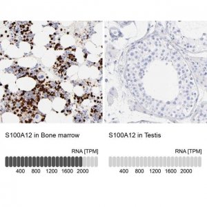 Anti-S100A12 antibody produced in rabbit 