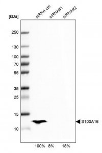 Anti-S100A16 antibody produced in rabbit 