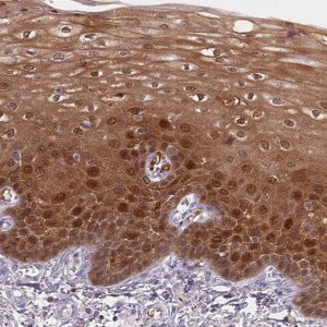 Anti-S100A2 antibody produced in rabbit HPA062451-100UL