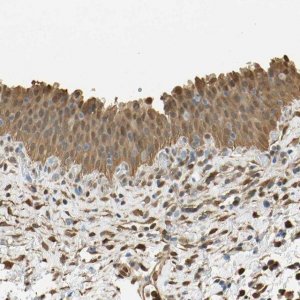 Anti-S100A6 antibody produced in rabbit 