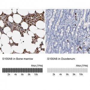 Anti-S100A8 antibody produced in rabbit 