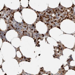 Anti-S100A8 antibody produced in rabbit 