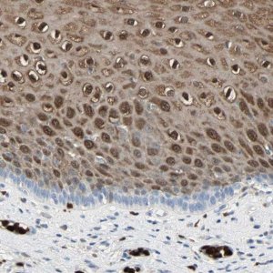 Anti-S100A9 antibody produced in rabbit 
