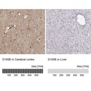 Anti-S100B antibody produced in rabbit 