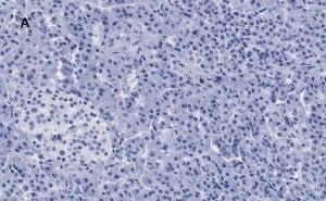 Anti-S6 Ribosomal Protein Antibody, clone 1E9, ZooMAb� Rabbit Monoclonal 
