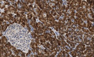 Anti-S6 Ribosomal Protein Antibody, clone 1E9, ZooMAb� Rabbit Monoclonal 
