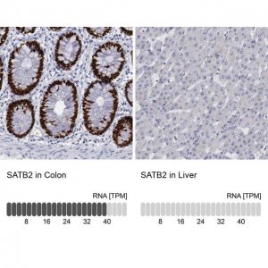 Anti-SATB2 antibody produced in rabbit 