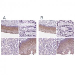 Anti-SBSN antibody produced in rabbit 