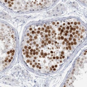 Anti-SCML1 antibody produced in rabbit 