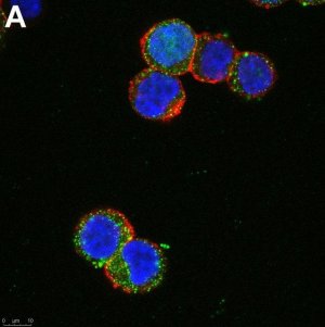 Anti-SCN2A Antibody, clone 3F19 ZooMAb� Rabbit Monoclonal 