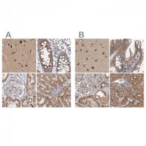 Anti-SCO1 antibody produced in rabbit 