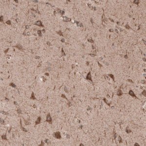 Anti-SEC31A antibody produced in rabbit 
