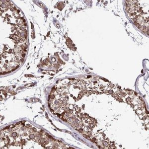 Anti-SEC63 antibody produced in rabbit 