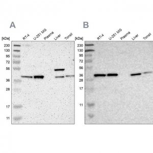 Anti-SERPINB6 antibody produced in rabbit HPA012736-100UL