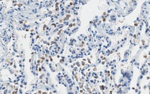 Anti-SFTPC Antibody, clone 3F18 ZooMAb� Rabbit Monoclonal 