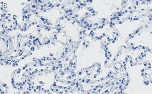 Anti-SFTPC Antibody, clone 3F18 ZooMAb� Rabbit Monoclonal 