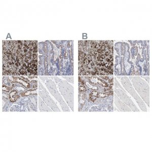 Anti-SGSH antibody produced in rabbit 