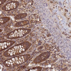Anti-SHARPIN antibody produced in rabbit 