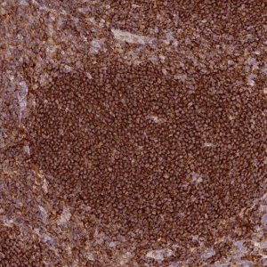 Anti-SIPA1 antibody produced in rabbit 