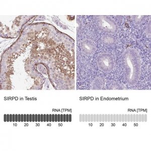 Anti-SIRPD antibody produced in rabbit 