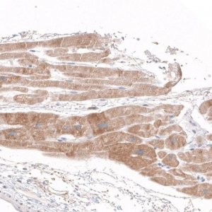 Anti-SIRT5 antibody produced in rabbit HPA021798-100UL