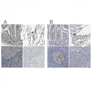 Anti-SKAP2 antibody produced in rabbit HPA005560-100UL
