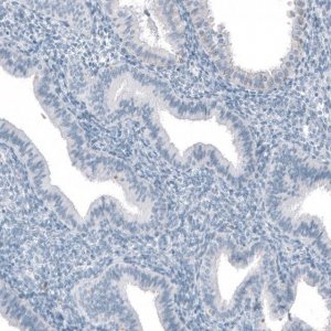 Anti-SLC22A2 antibody produced in rabbit 