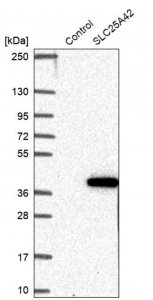 Anti-SLC25A42 antibody produced in rabbit 