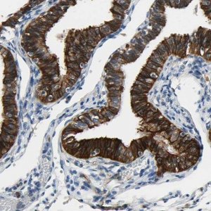 Anti-SLC27A6 antibody produced in rabbit HPA008987-100UL
