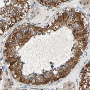 Anti-SLC27A6 antibody produced in rabbit HPA008987-100UL