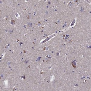 Anti-SLC33A1 antibody produced in rabbit 