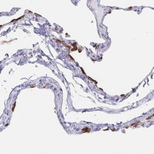 Anti-SLC34A2 antibody produced in rabbit 