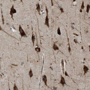 Anti-SLC36A4 antibody produced in rabbit 