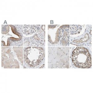 Anti-SLC38A10 antibody produced in rabbit 