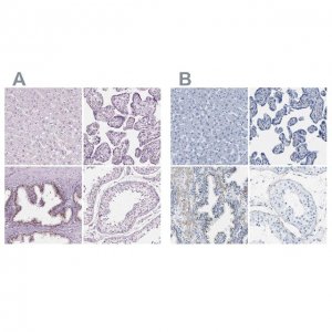 Anti-SLC45A3 antibody produced in rabbit 