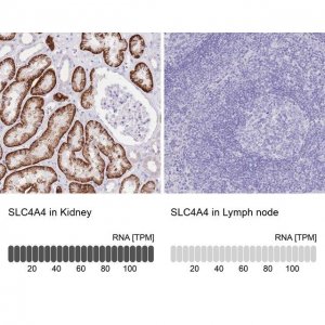 Anti-SLC4A4 antibody produced in rabbit 