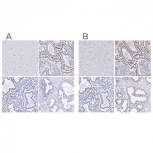 Anti-SLC5A1 antibody produced in rabbit 