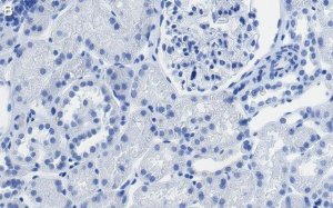 Anti-SLC5A2 Antibody, clone 2I4 ZooMAb� Rabbit Monoclonal 